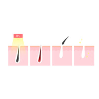 Silhouette Portable Laser Hair Remover Permanent Epliation System Body Face Home Kings Warehouse