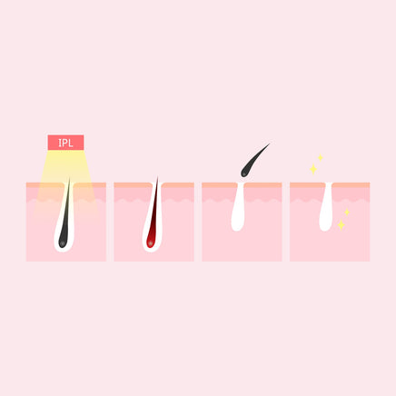 Silhouette Portable Laser Hair Remover Permanent Epliation System Body Face Home Kings Warehouse