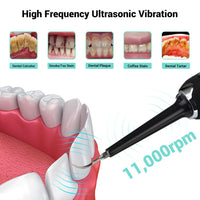 High Frequency Electric Ultrasonic Dental Tartar Plaque Calculus Tooth Remover Set Kits Cleaner with LED Screen Black Health & Beauty Kings Warehouse 